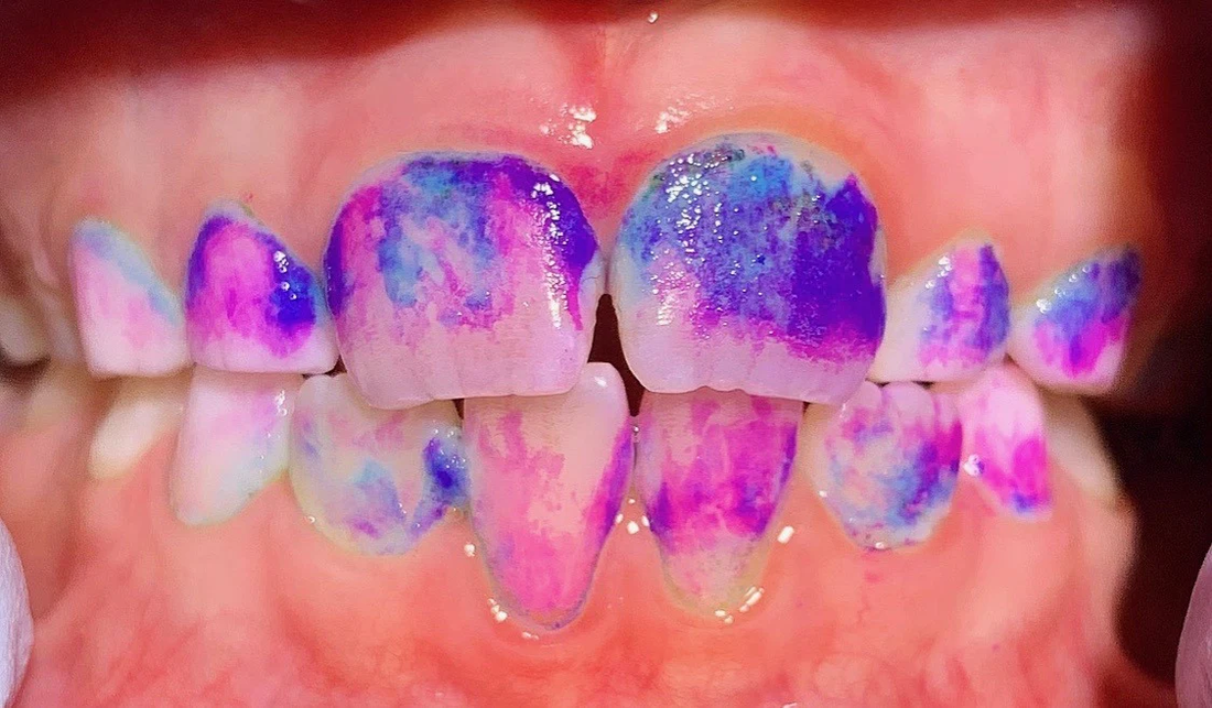 Pastillas reveladoras de placa modo de uso