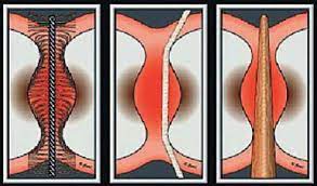 Curaprox Prime 06mm / 1 Unidad