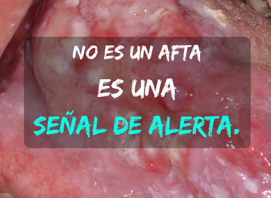 Cinco hallazgos sorprendentes sobre tu boca y el riesgo de cáncer