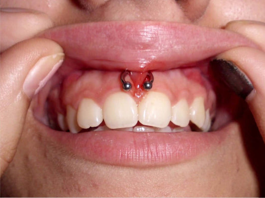 Piercings en labios y lengua, daños irreversibles en la boca